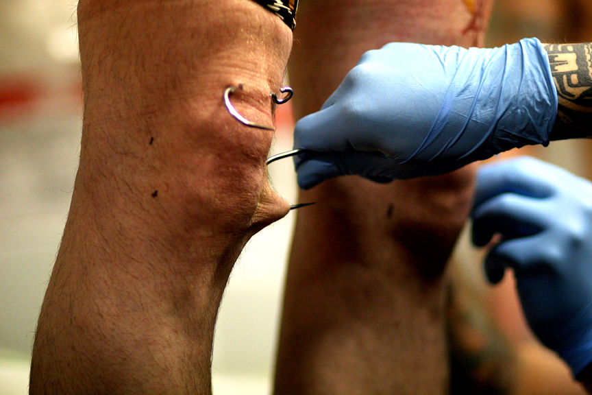 Preparing a knee suspension