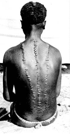"Scarification pattern among the Great Andamanese in the late 19th century. Nothing is known of the origins or antiquity of this custom among the Andamanese."Citation from Clothes, Clay and Beautycar