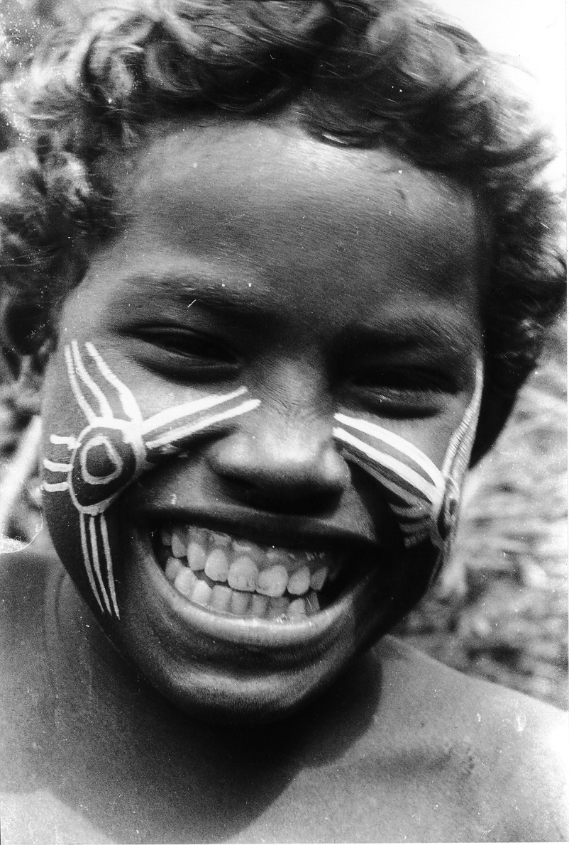 Scarifications récemment rafraîchies sur le visage d’un enfant. Les scarifications sous les tempes représentent des ailes stylisées d’une frégate et sur les joues, une trace de bernard-l’hermite.