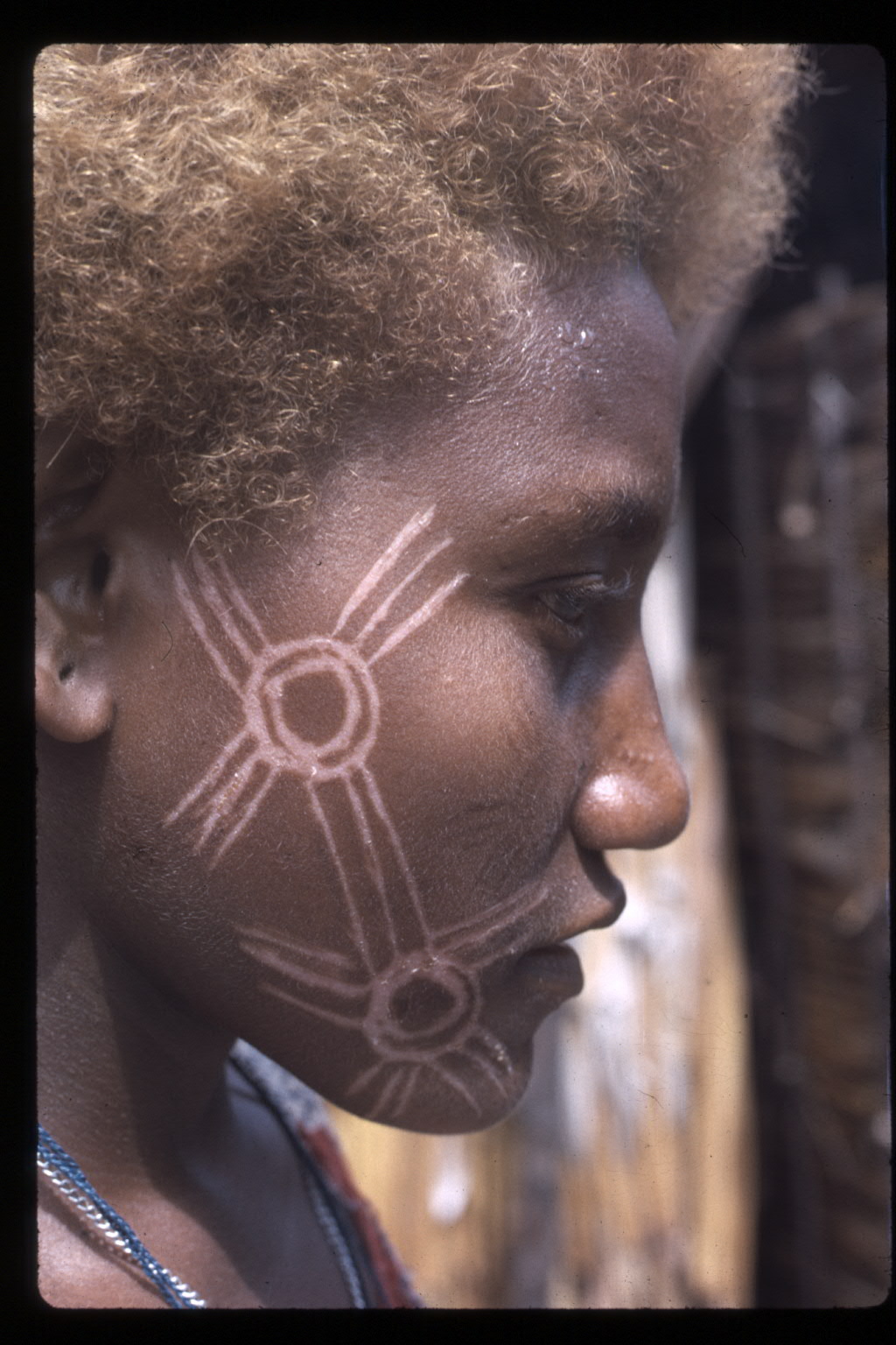 Scarifications récemment rafraîchies sur le visage d’un enfant. Les symboles représentent son appartenance à son clan.