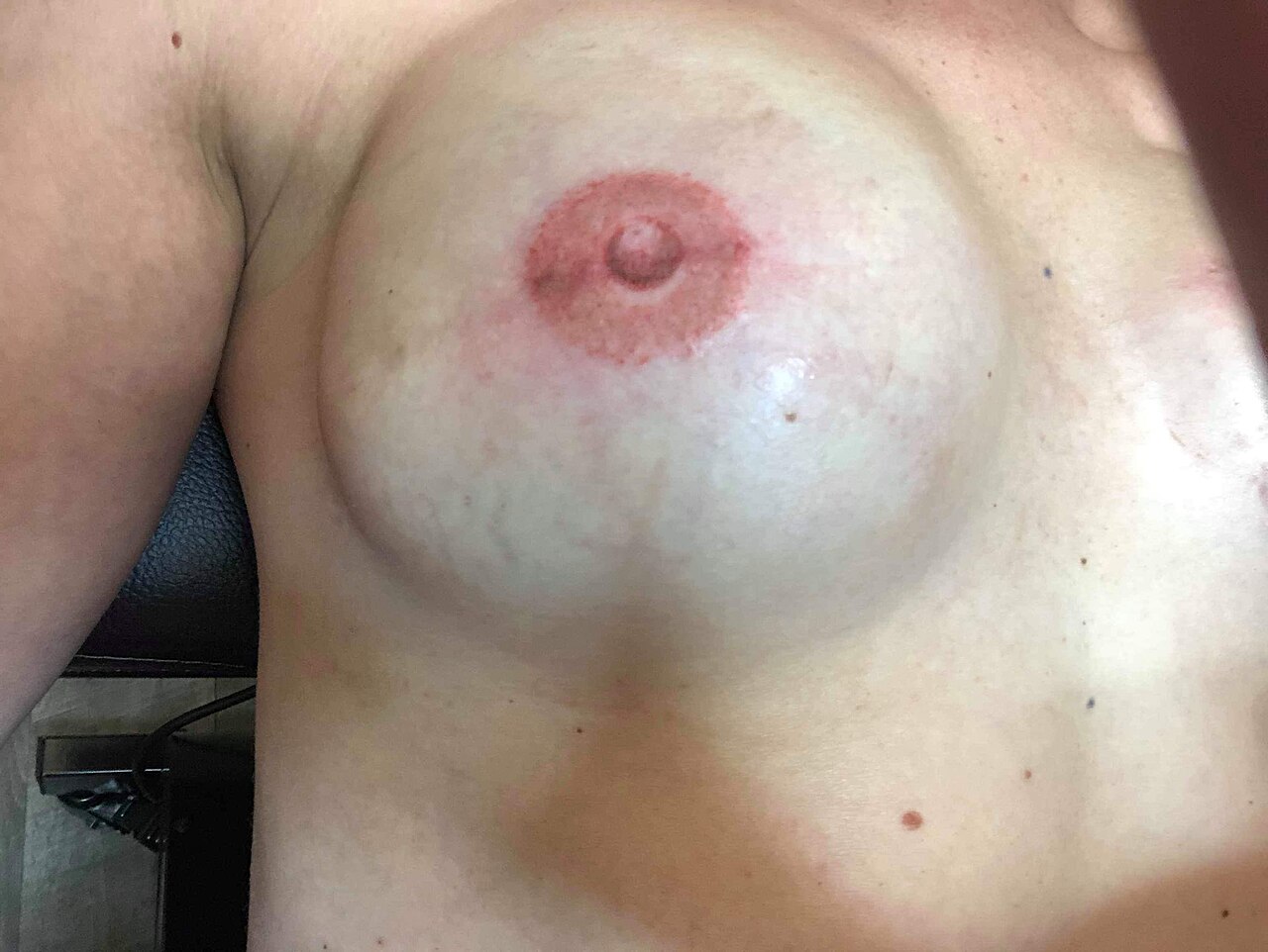 Areola Micropigmentation Nipple Tattoo