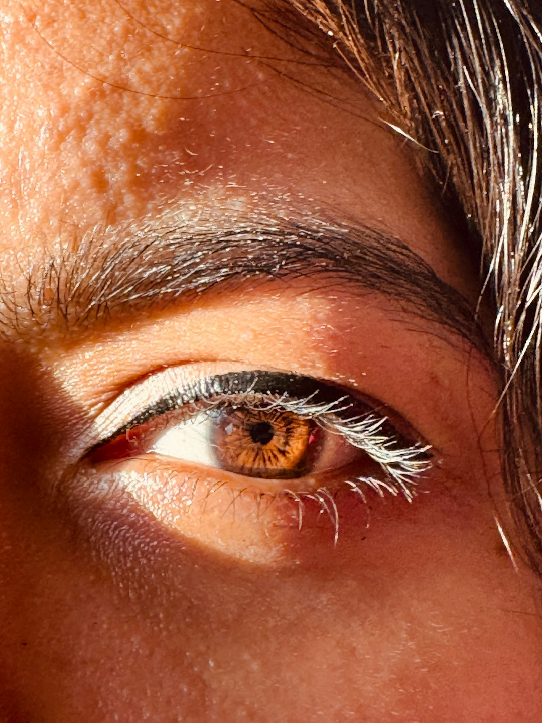 Eye