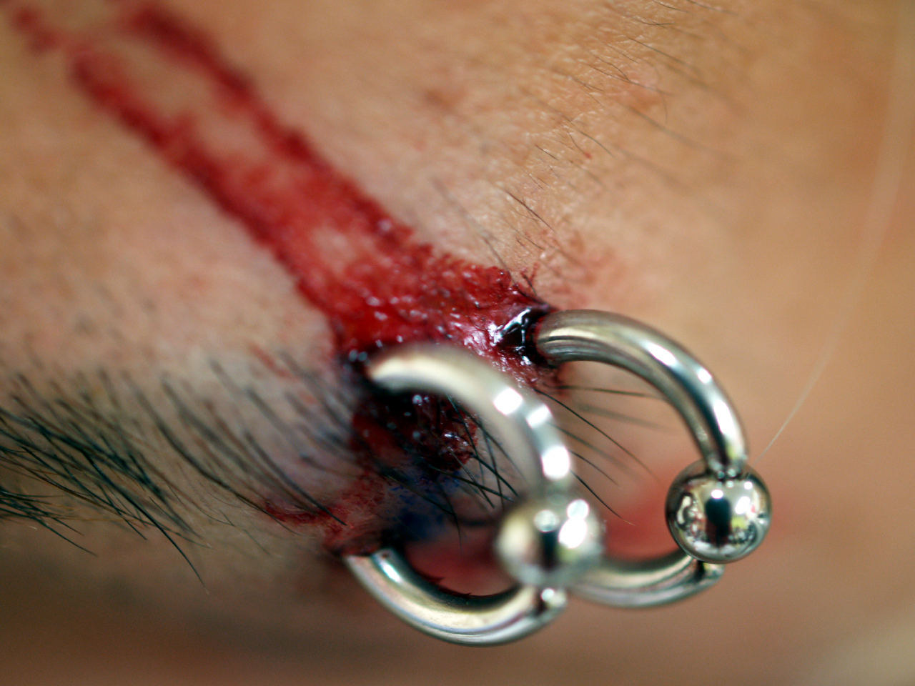 Bloody eyebrow piercings
