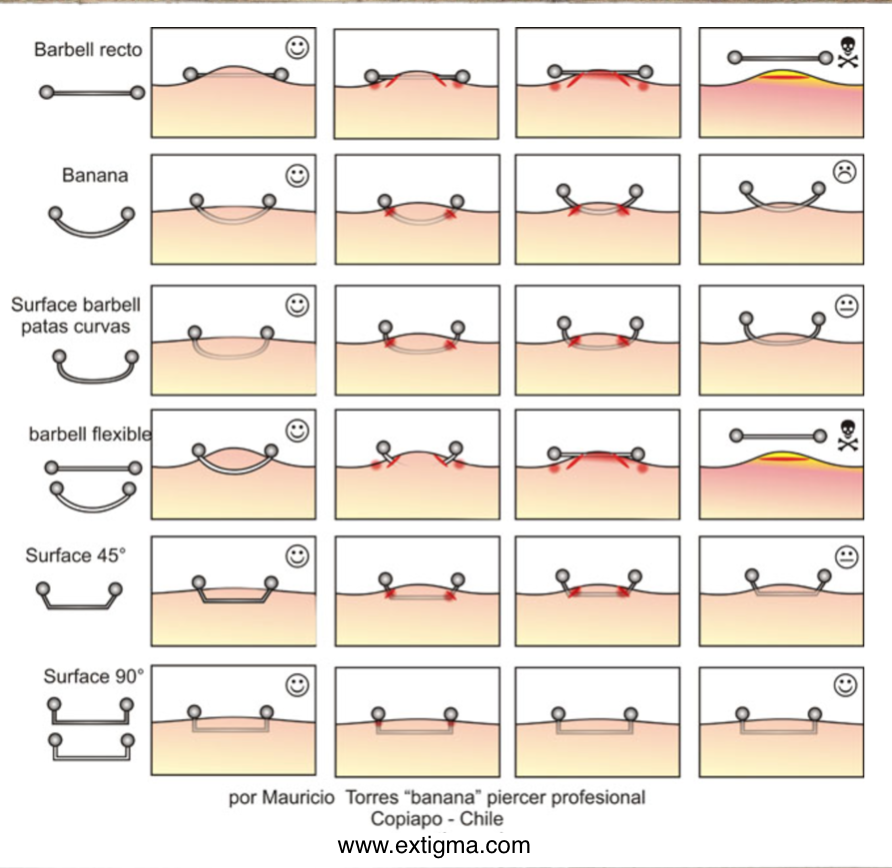 en este grafico podemos ver los distintos resultados de una perforación de tipo surface, realizada con joyas como barbells, barbells curvos, surface de formas inadecuadas o joyeria flexible, demostran