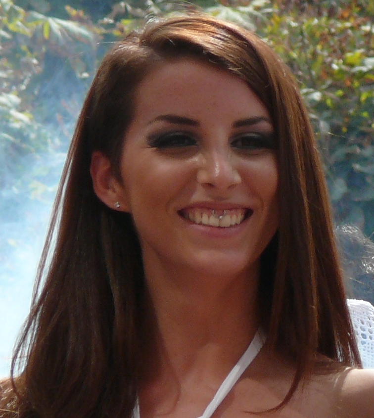 Smiling Woman With Upper Lip Frenulum Piercing.