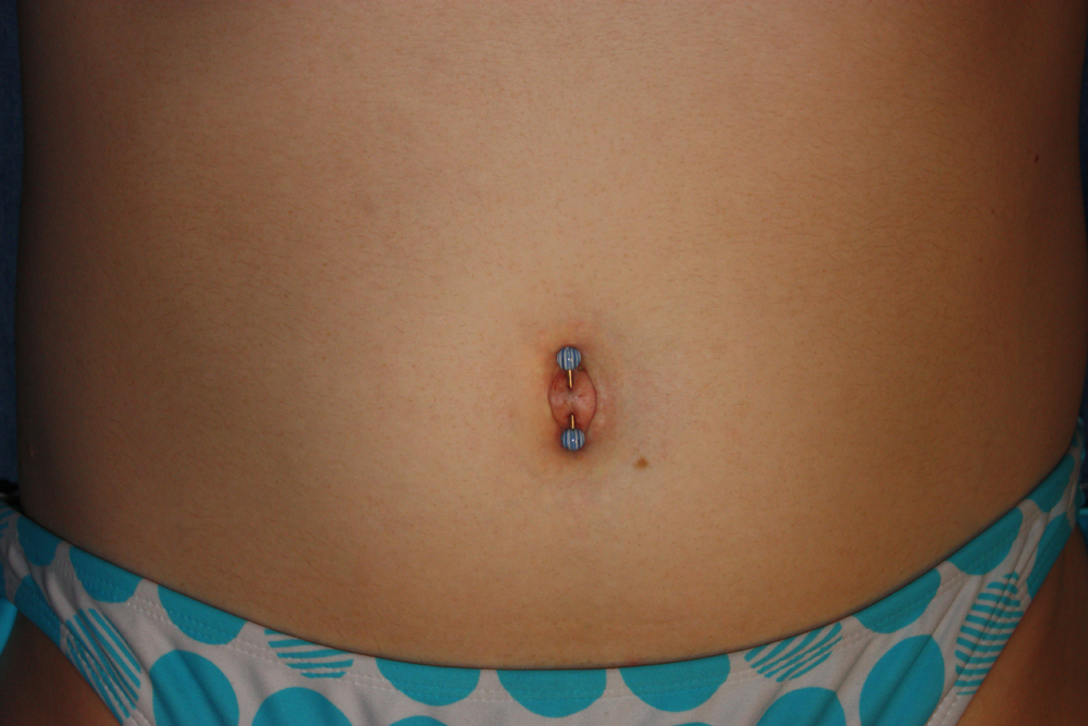 Pierced outie belly button, True belly button piercing