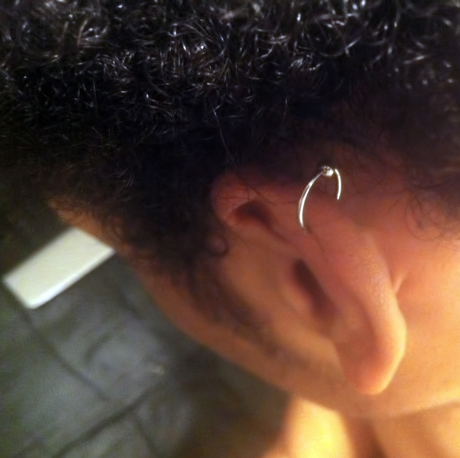 A CBR located on the helix portion of the ear.
