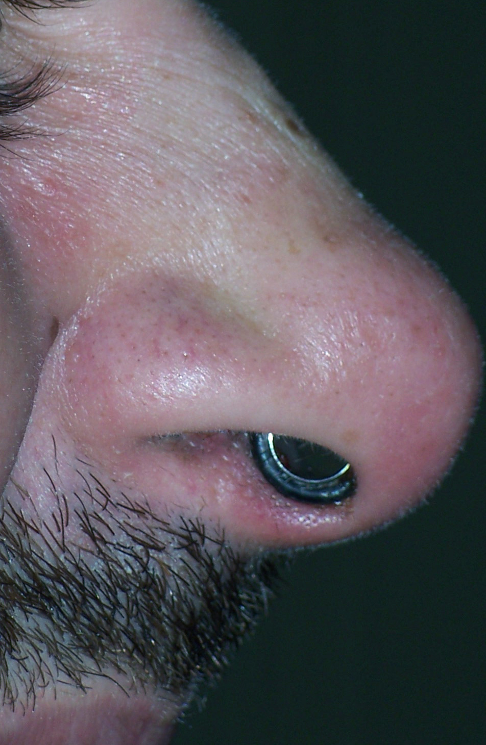 This is a photo I took of my 0g septum piercing shortly after being stretched from 2g at Evolved Body Art in Columbus, Ohio. The stretching from the initial 12g piercing to 4g was done by dead stretch