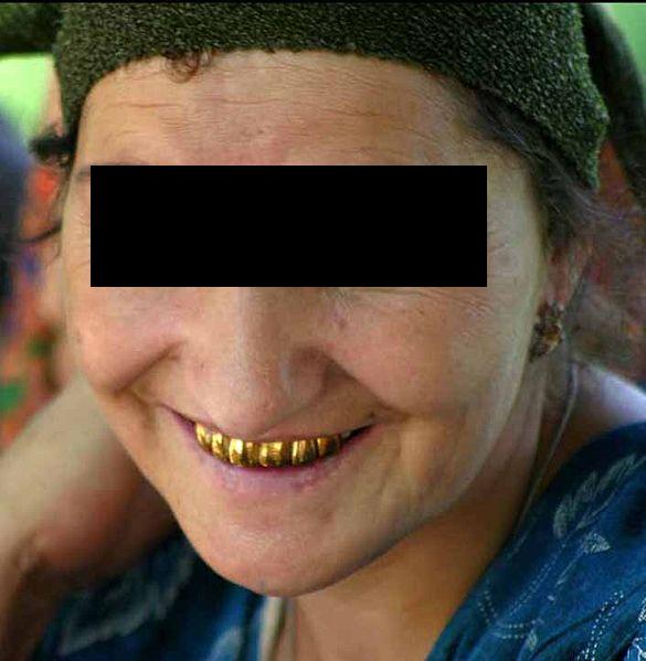 A Tajik woman with gold teeth
