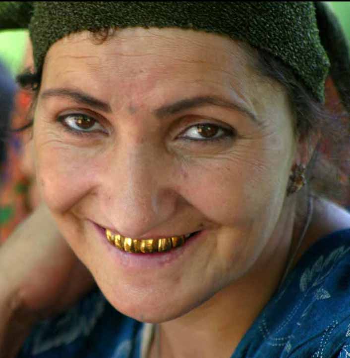 A Tajik woman with gold teeth.
