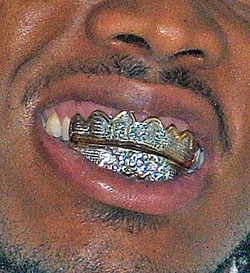 Photo of a man with a dental grill, taken in 2006 or 2007 by me, Louis F. Sander, LSander153@aol.com